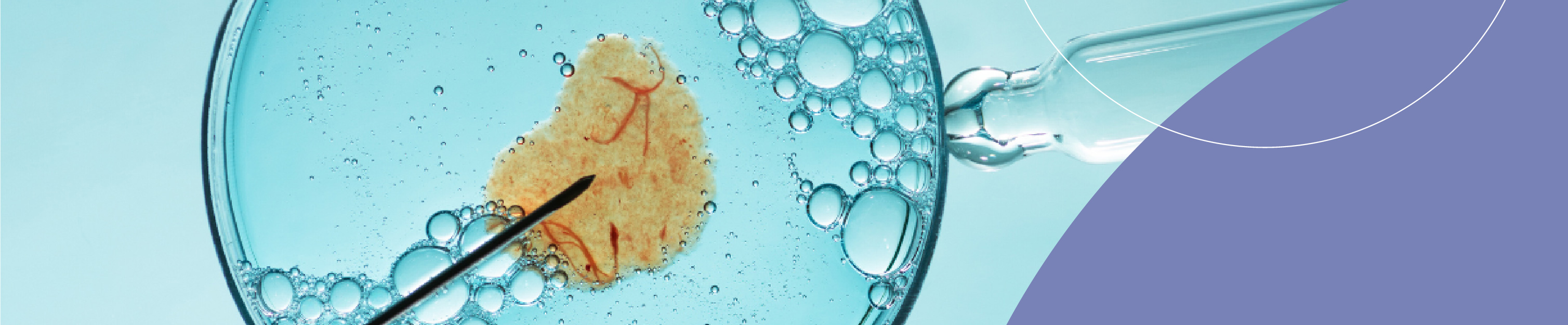 Fertilização In-Vitro (FIV)